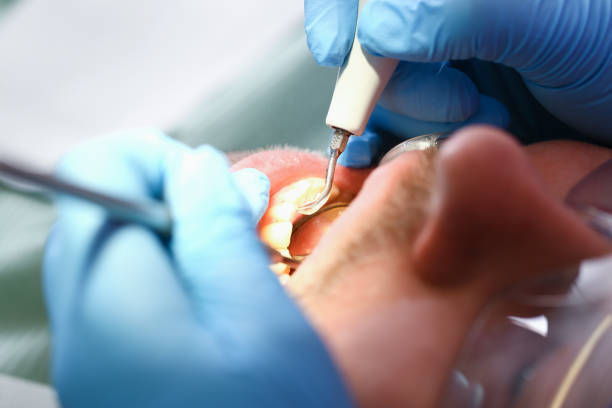Fast & Reliable Emergency Dental Services in SD