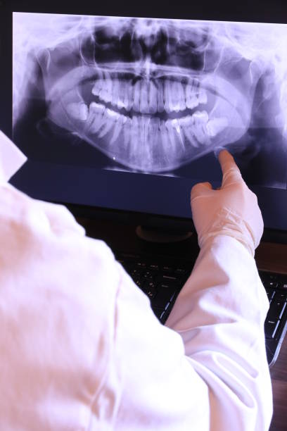 Best Emergency Wisdom Teeth Removal in North Sioux City, SD